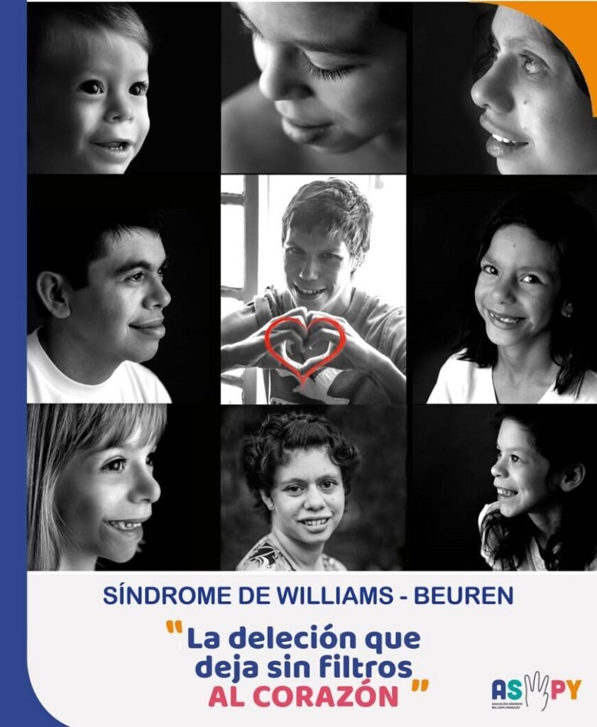 Síndrome de Williams: apoyo e interacción entre familias son de gran ayuda
